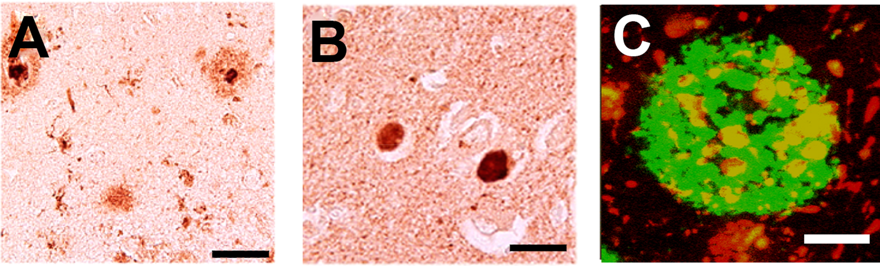 Correction to: Role of Synucleins in Alzheimer’s Disease