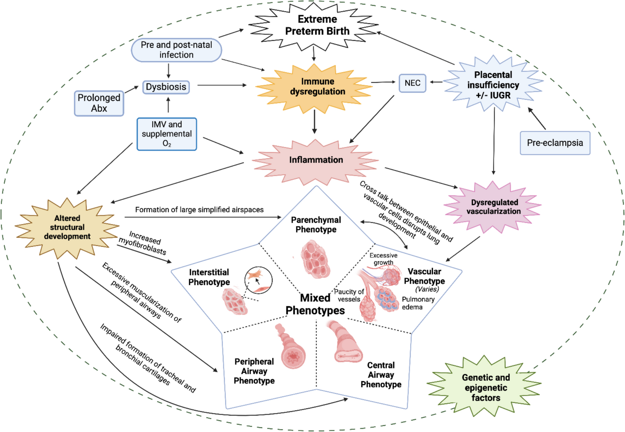 Current and Emerging Therapies for Prevention and Treatment of Bronchopulmonary Dysplasia in Preterm Infants