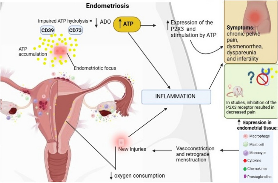 The role of purinergic P2X3 receptors and endometriosis-associated hyperalgesia