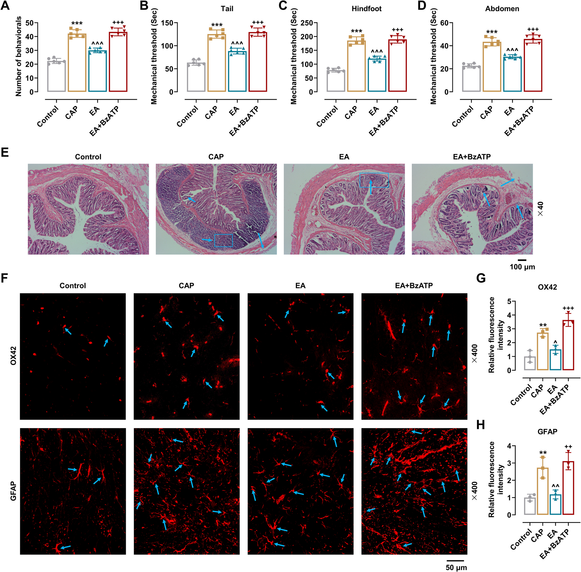 Electroacupuncture alleviates capsaicin-induced rectal visceral pain in rats via inhibiting TRPV1 expression by blocking the P2X4R-activated p38 pathway