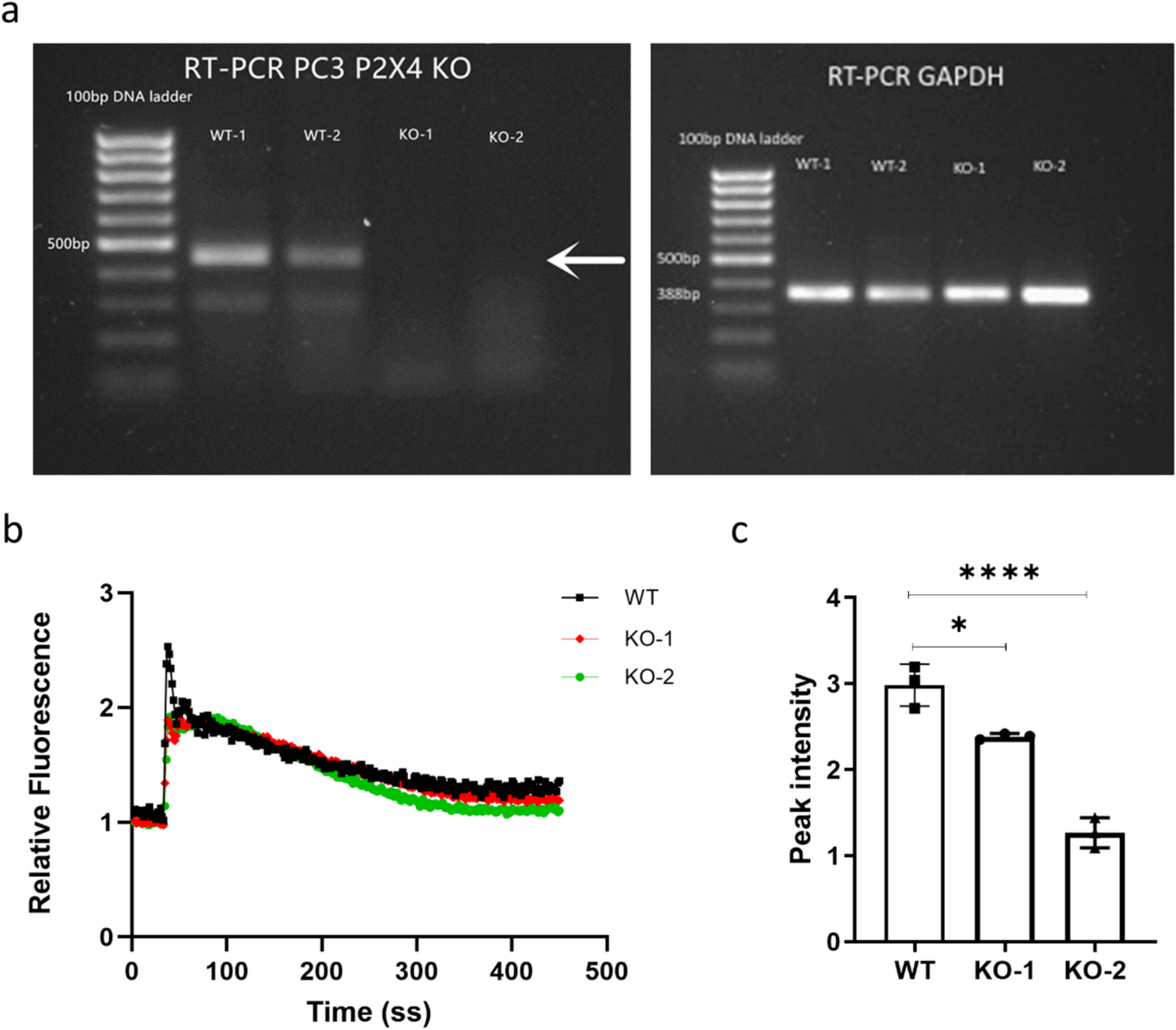 Depletion of P2X4 receptor alleviates prostate cancer bone metastasis through reduced cancer cell invasiveness and enhanced cell adhesion activities