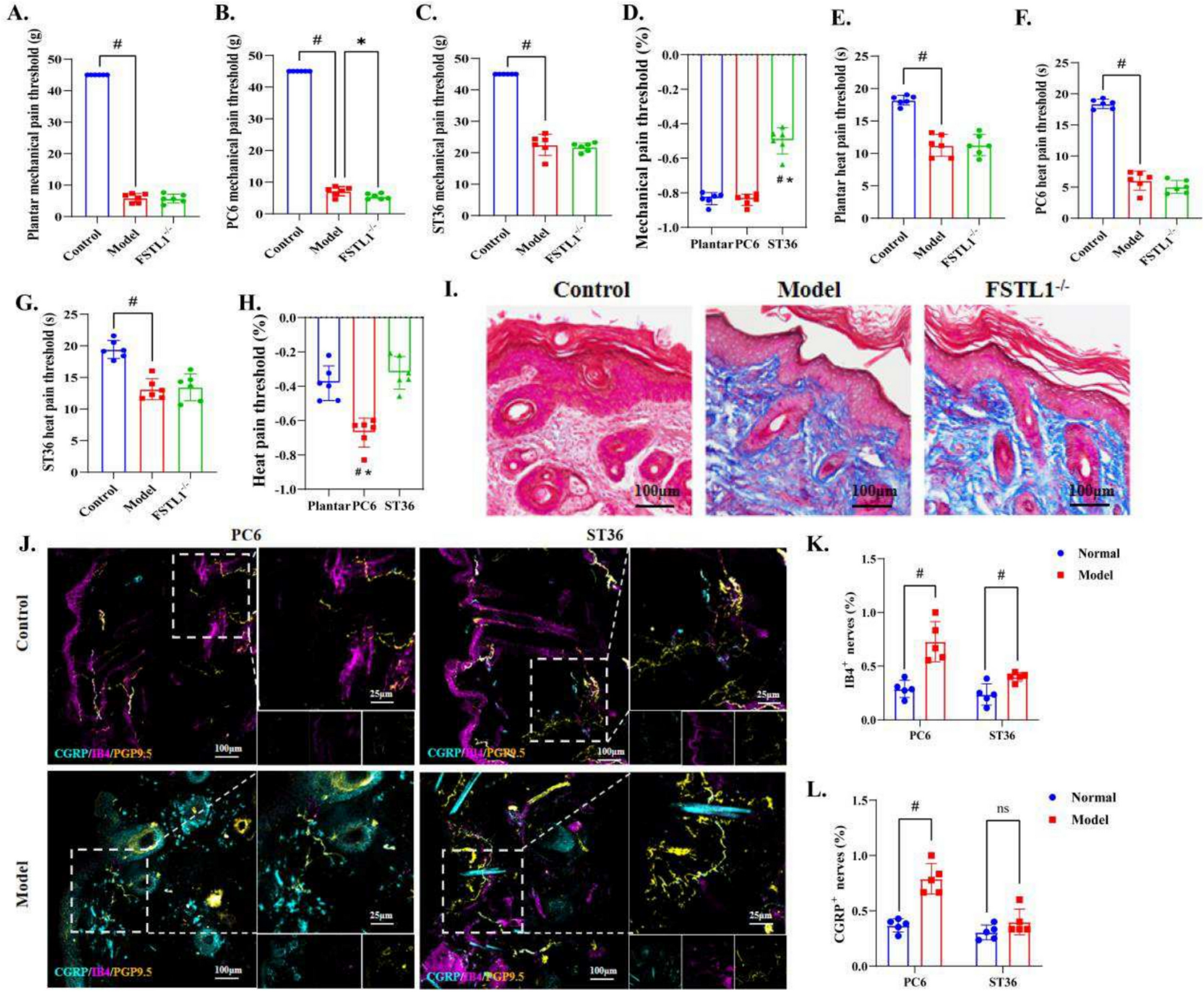 P2Y6 promoted pruning of FSTL1 nerves by cutaneous macrophages to reset pain threshold and cardiac function