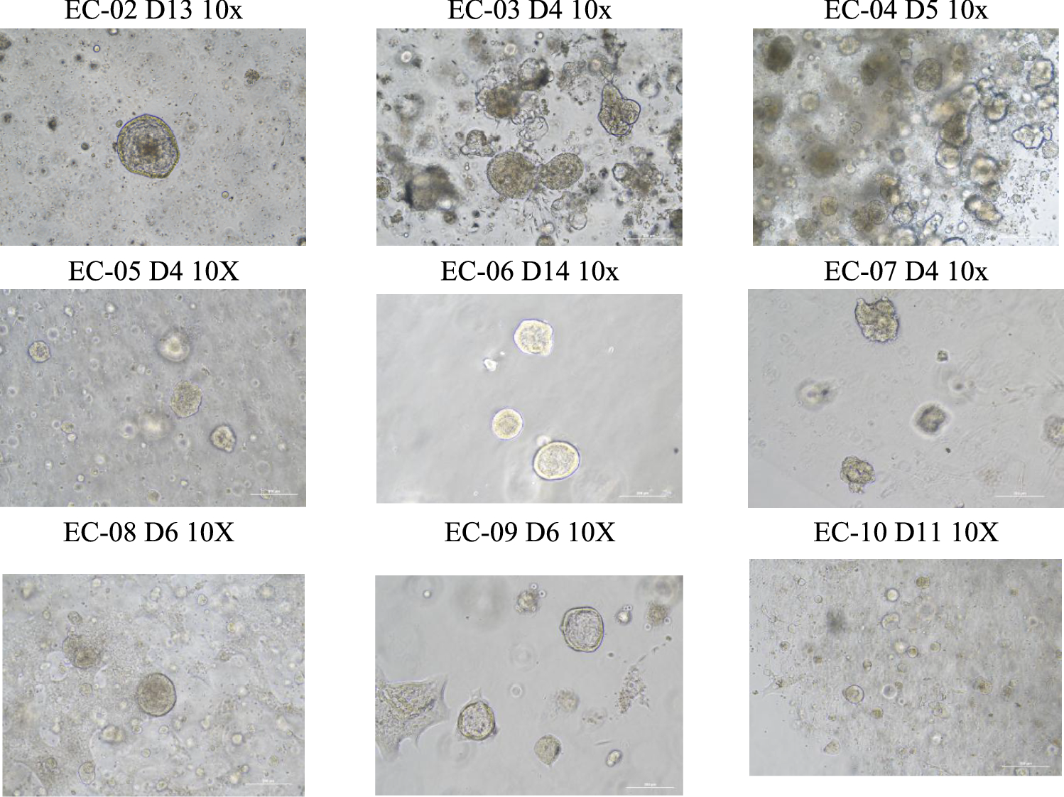 Establishment and Characterization of a Durable and Versatile Endometrial Cancer Organoid Database