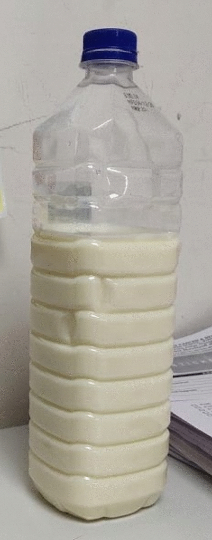 Rare Complication of Chylous Ascites Following Surgery and Radiotherapy in Endometrial Carcinoma Managed by Diet Modification: Case Report