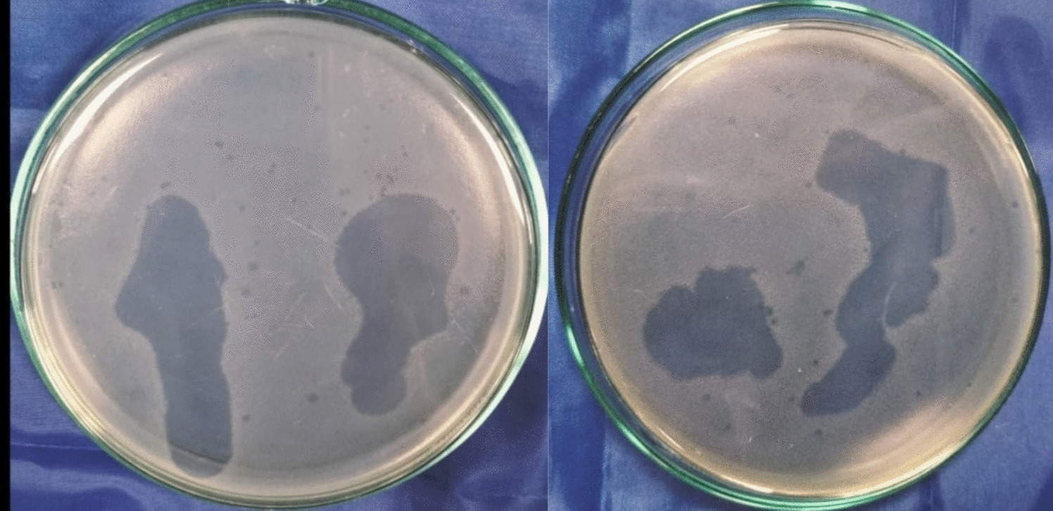 Genomic characterization and pre-clinical evaluation of a new polyvalent lytic  phage