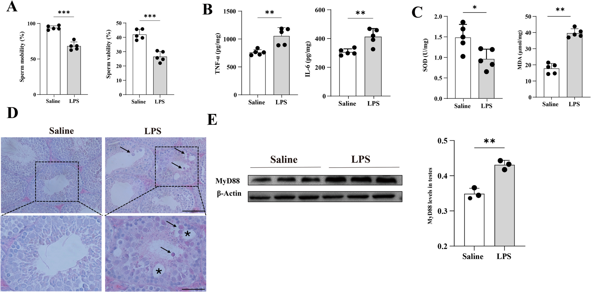 MyD88 Signaling in Sertoli Cells Mediates LPS-Induced Orchitis in Mice