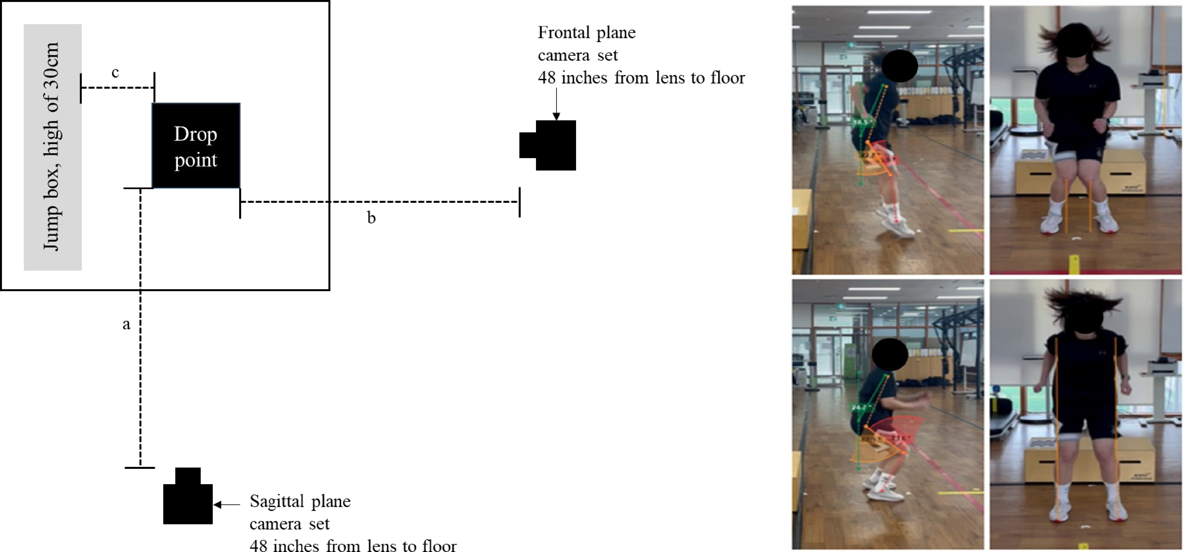 Anterior cruciate ligament injury risk according to sleep quality in female college students