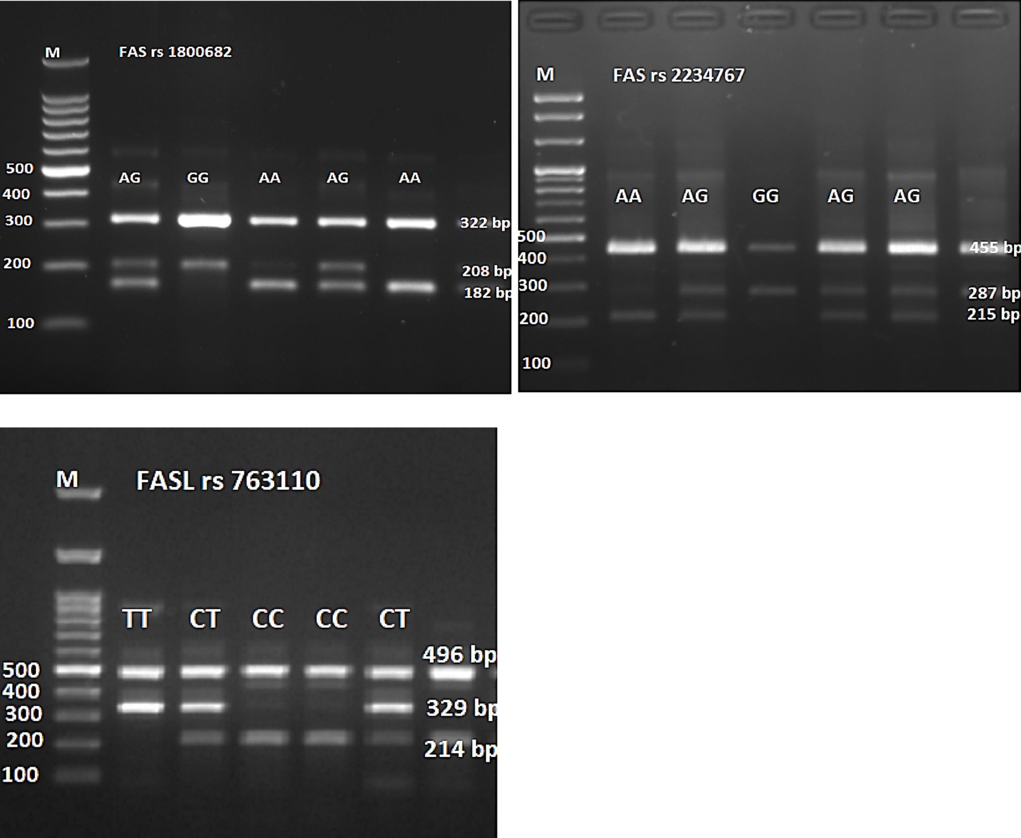 Genetic Determinants of Apoptosis Regulate Liver Cirrhosis Risk: The FAS/FASL Polymorphism Connection in Iraqi Population