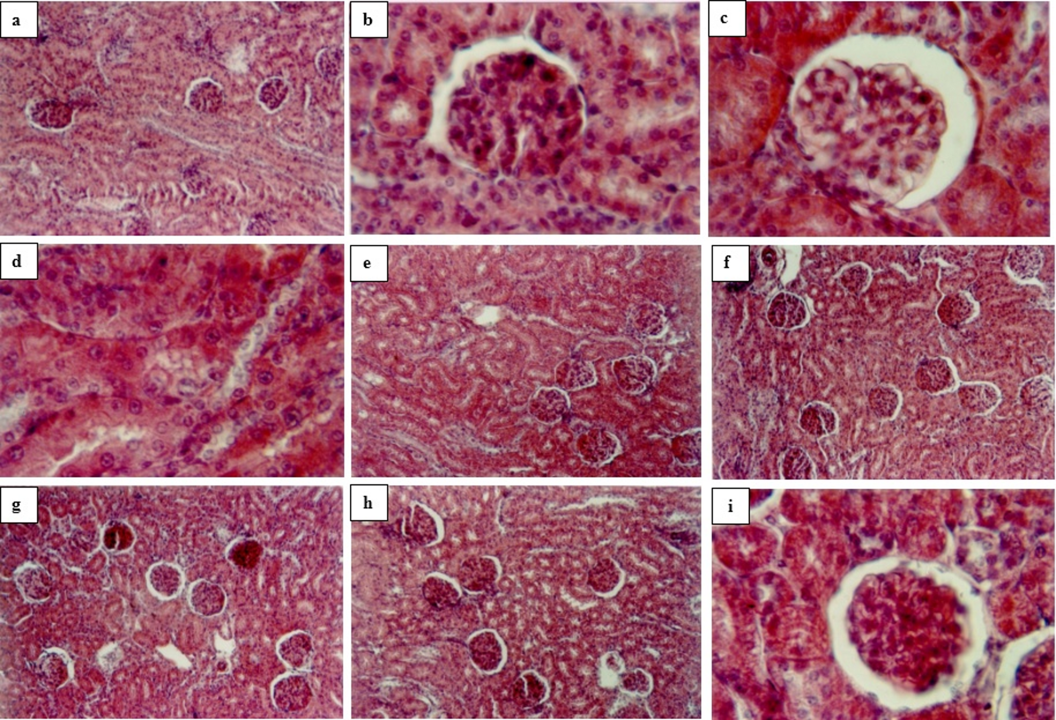 Combined Effects of Lipoic Acid and Dimercaptosuccinic Acid in Improving Lead-Induced Alterations on Glucose Metabolism, Energy Metabolism and Tissue Histology