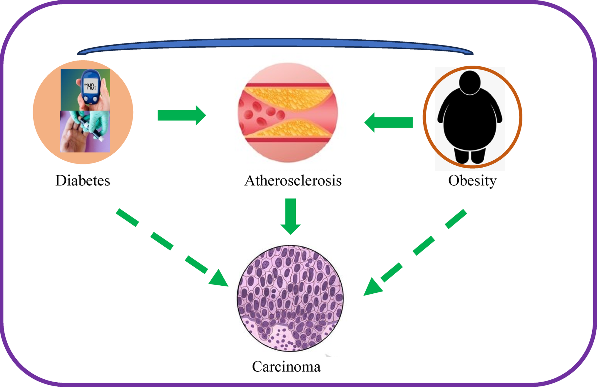 Carcinogenic Link to Diabetes, Obesity and Atherosclerosis—A Focus on Differently Programmed Cholesterol Homeostasis