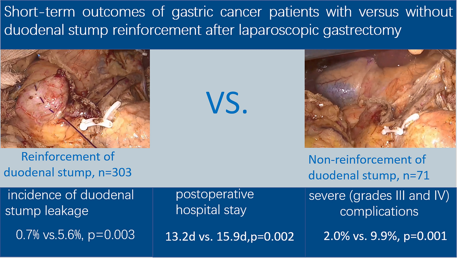 Short-term outcomes of gastric cancer patients with versus without duodenal stump reinforcement after laparoscopic gastrectomy