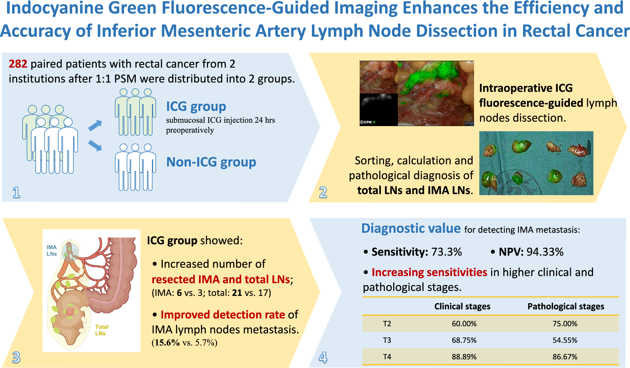 Indocyanine green fluorescence-guided imaging enhances the efficiency and accuracy of inferior mesenteric artery lymph node dissection in rectal cancer