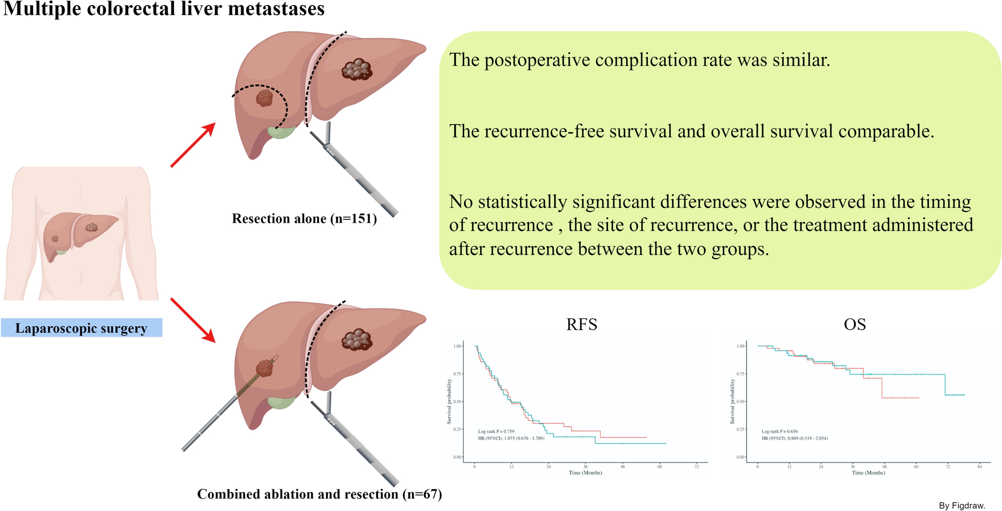 Laparoscopic resection combined with ablation for multiple colorectal liver metastases: a multicentre propensity-matched analysis