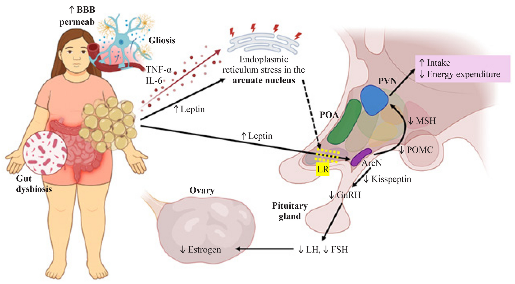 Metabolic inflammatory hypothalamic-induced reproductive dysfunction: a new paradigm in adolescent reproductive-endocrine health