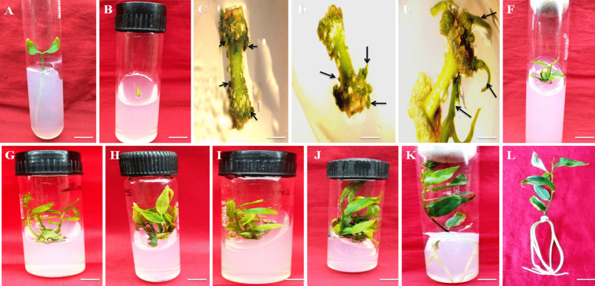 Micropropagation of  (Wall.) Hurusawa—a valuable medicinal plant through root culture and evaluation of its genetic fidelity and metabolomics