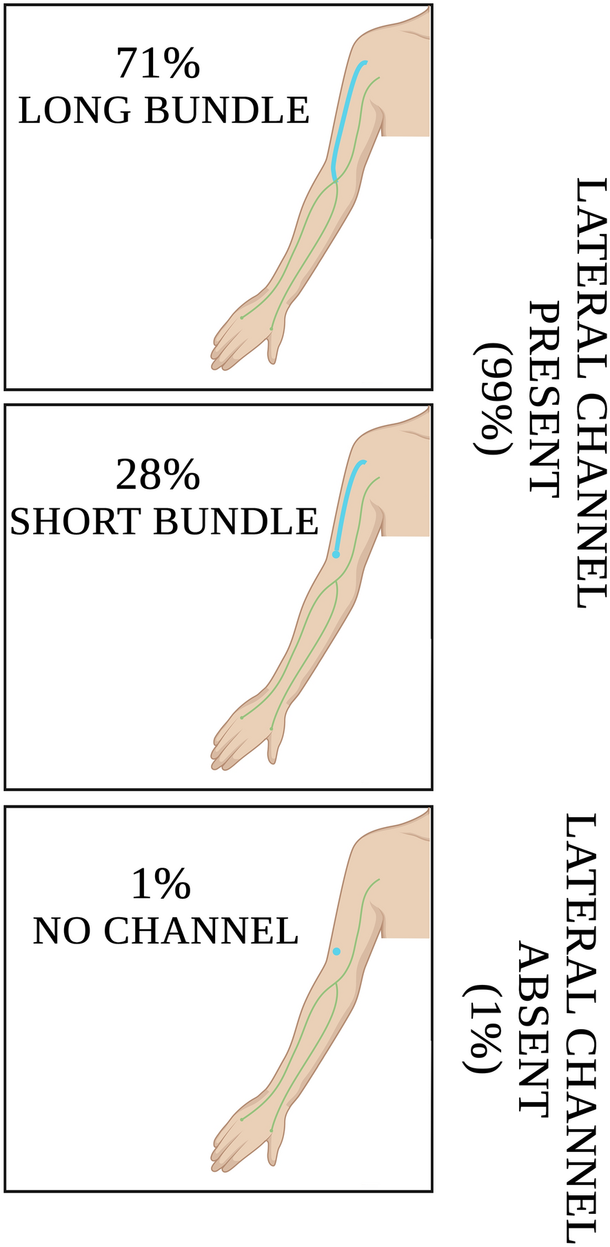 Major anatomic variations of the lateral upper arm lymphatic pathway in a healthy female population