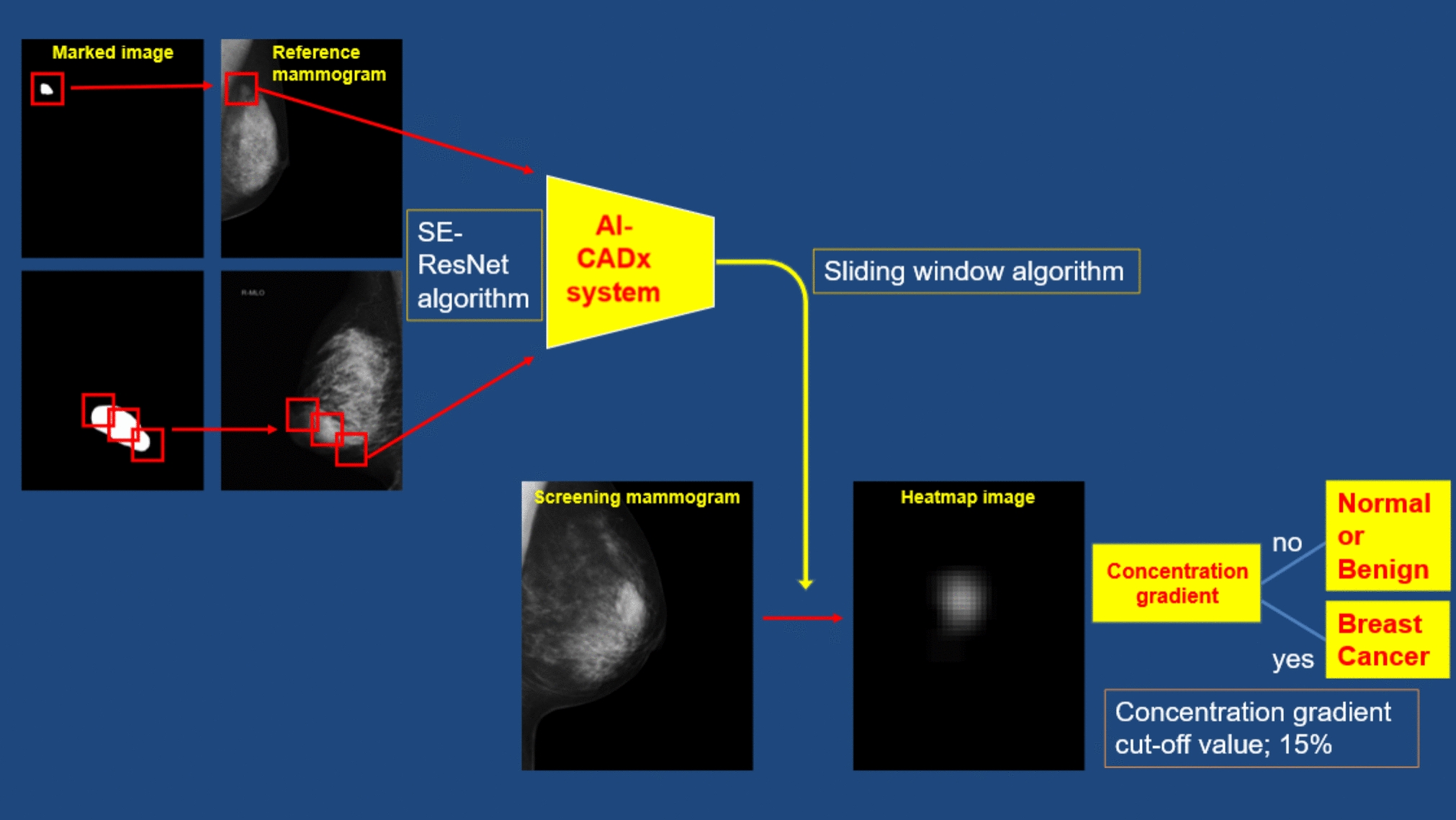 Development of a deep learning-based automated diagnostic system (DLADS) for classifying mammographic lesions — a first large-scale multi-institutional clinical trial in Japan