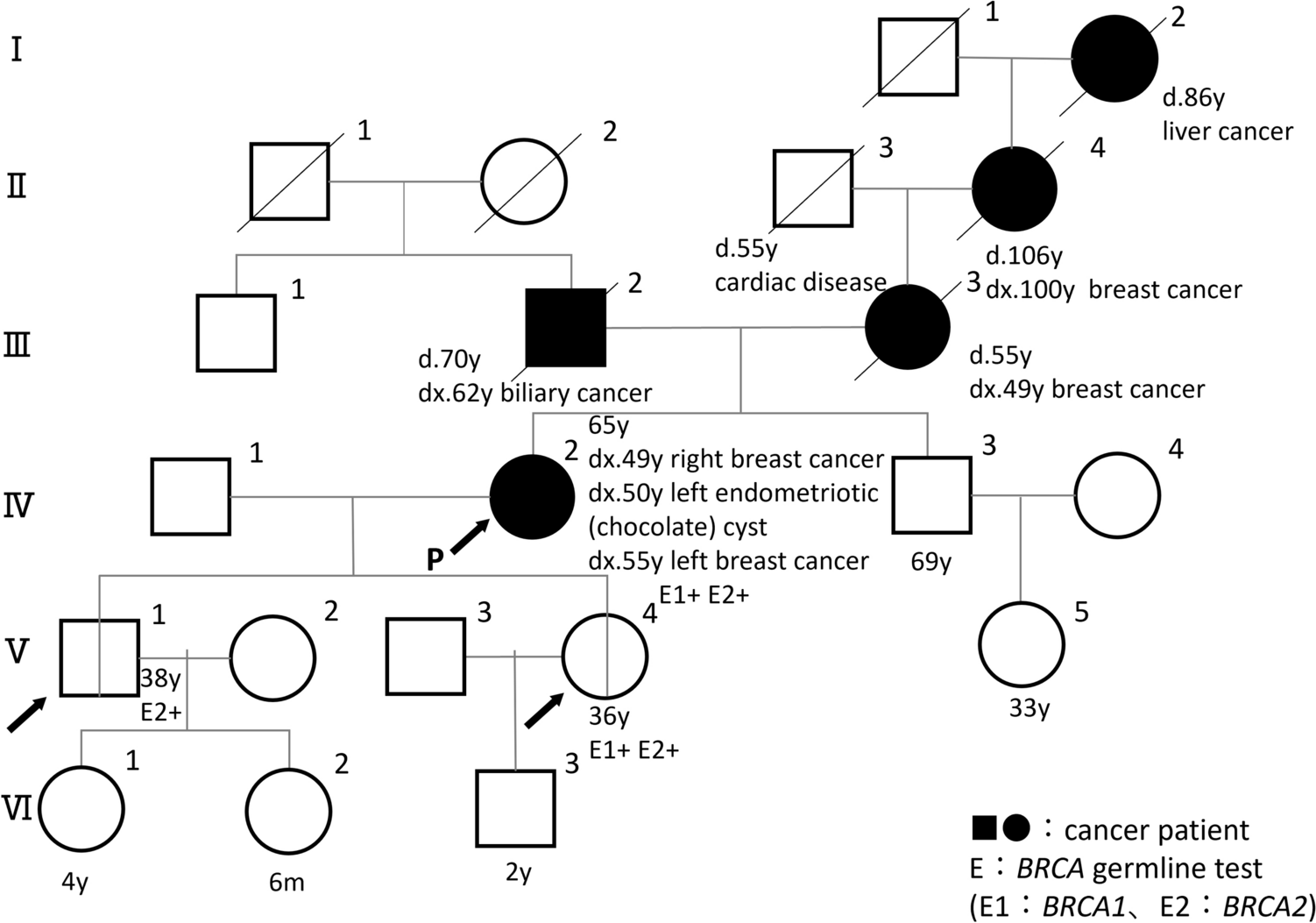 Two-hit events occurred independently in bilateral breast cancers in a germline double heterozygous carrier for and