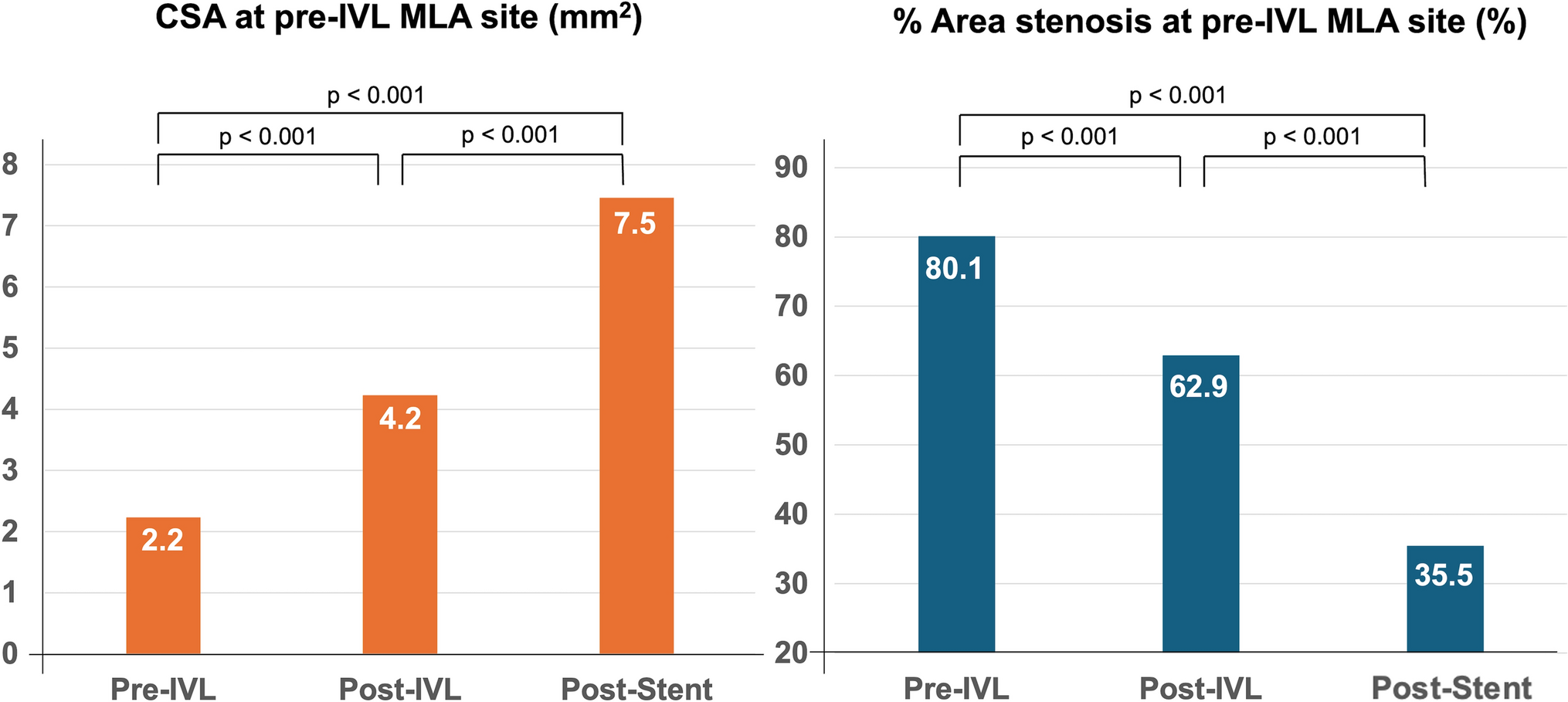 Efficacy and safety of intravascular ultrasound-guided percutaneous coronary intervention with intravascular lithotripsy for severe calcified lesions