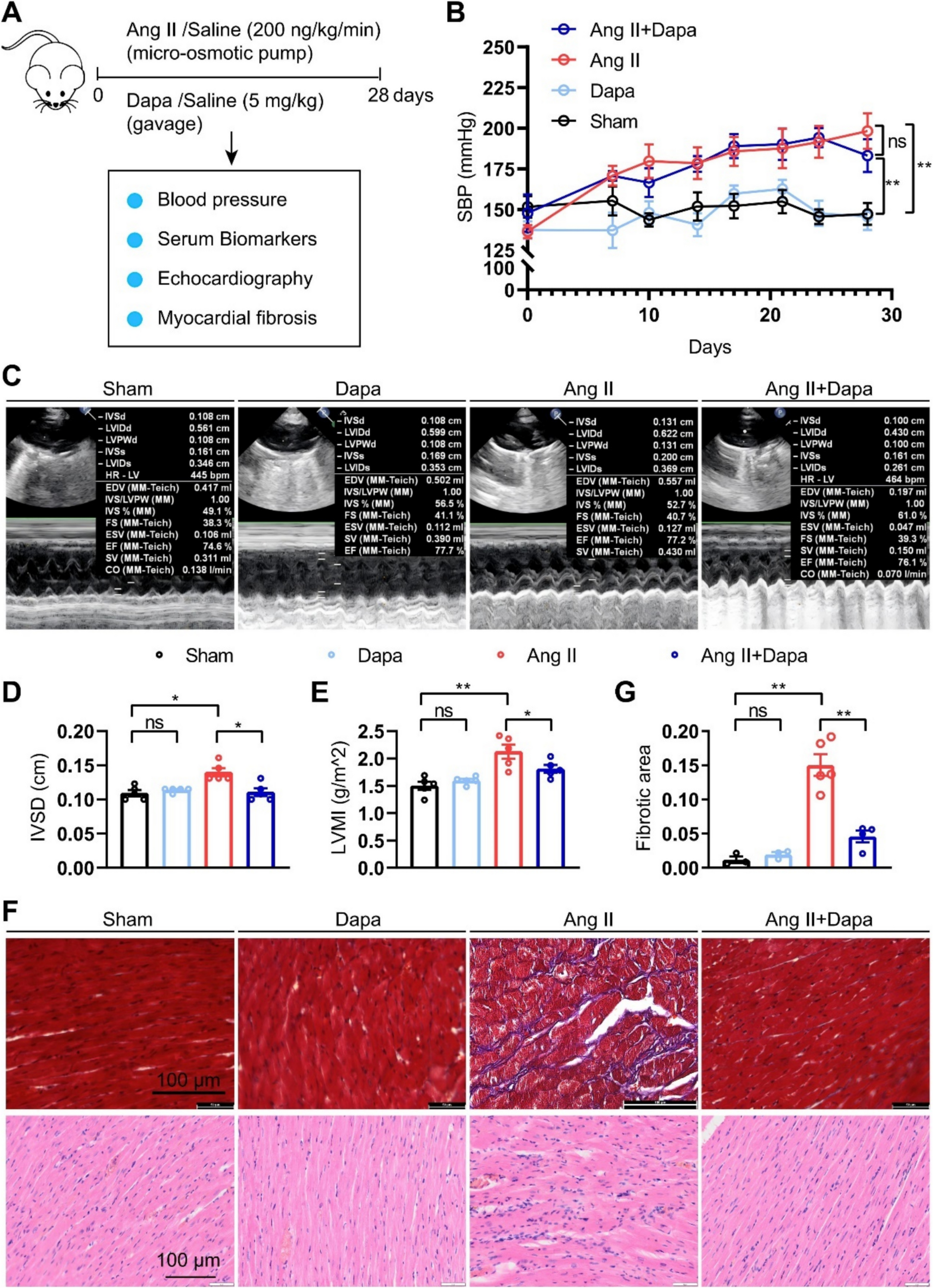 Early cardioprotective effects of SGLT2i on hypertensive cardiac remodeling via STIM1/Orai1-dependent calcium signaling: beyond blood pressure control