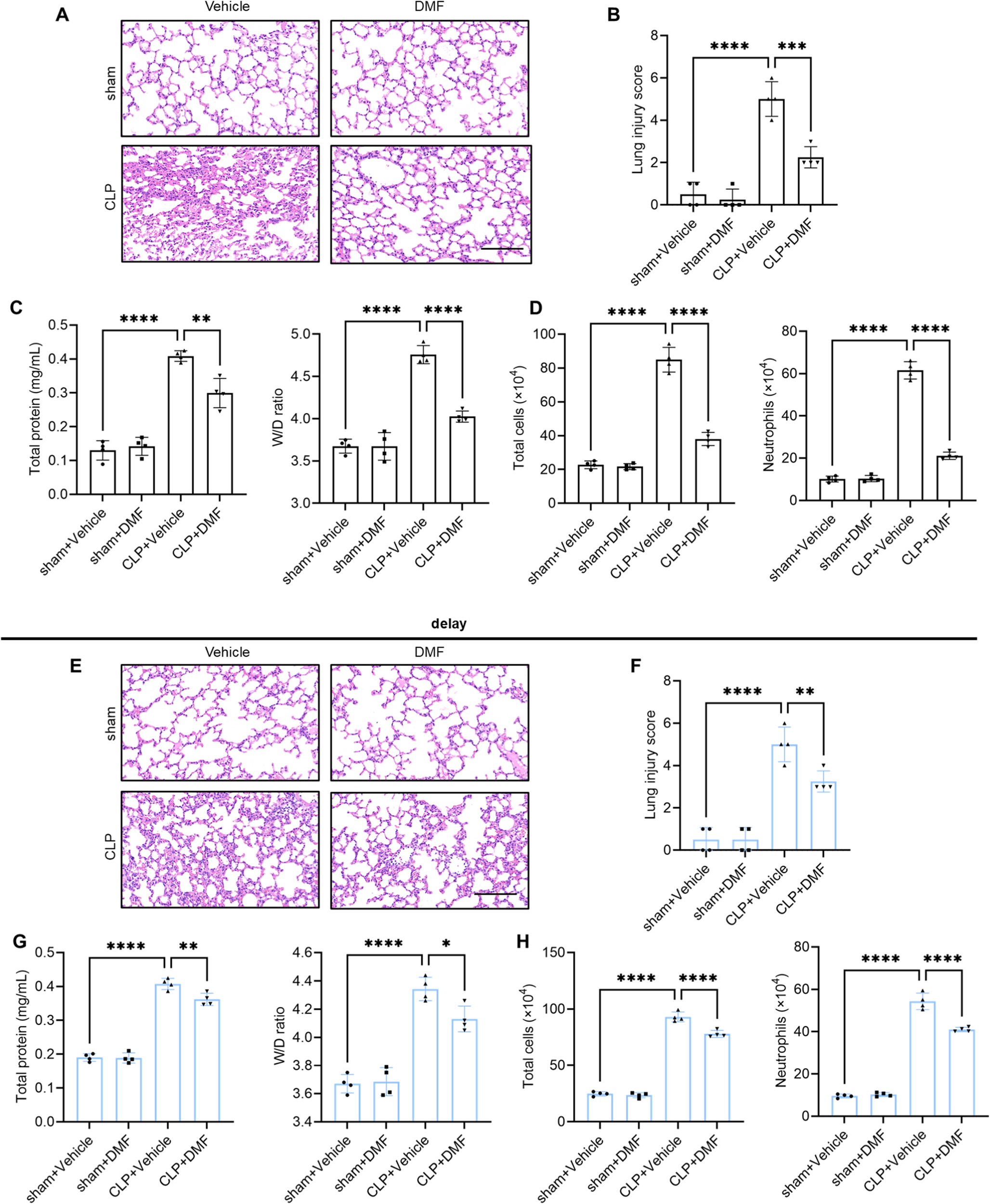 Dimethyl fumarate improves sepsis-induced acute lung injury by inhibiting STING-mediated ferroptosis