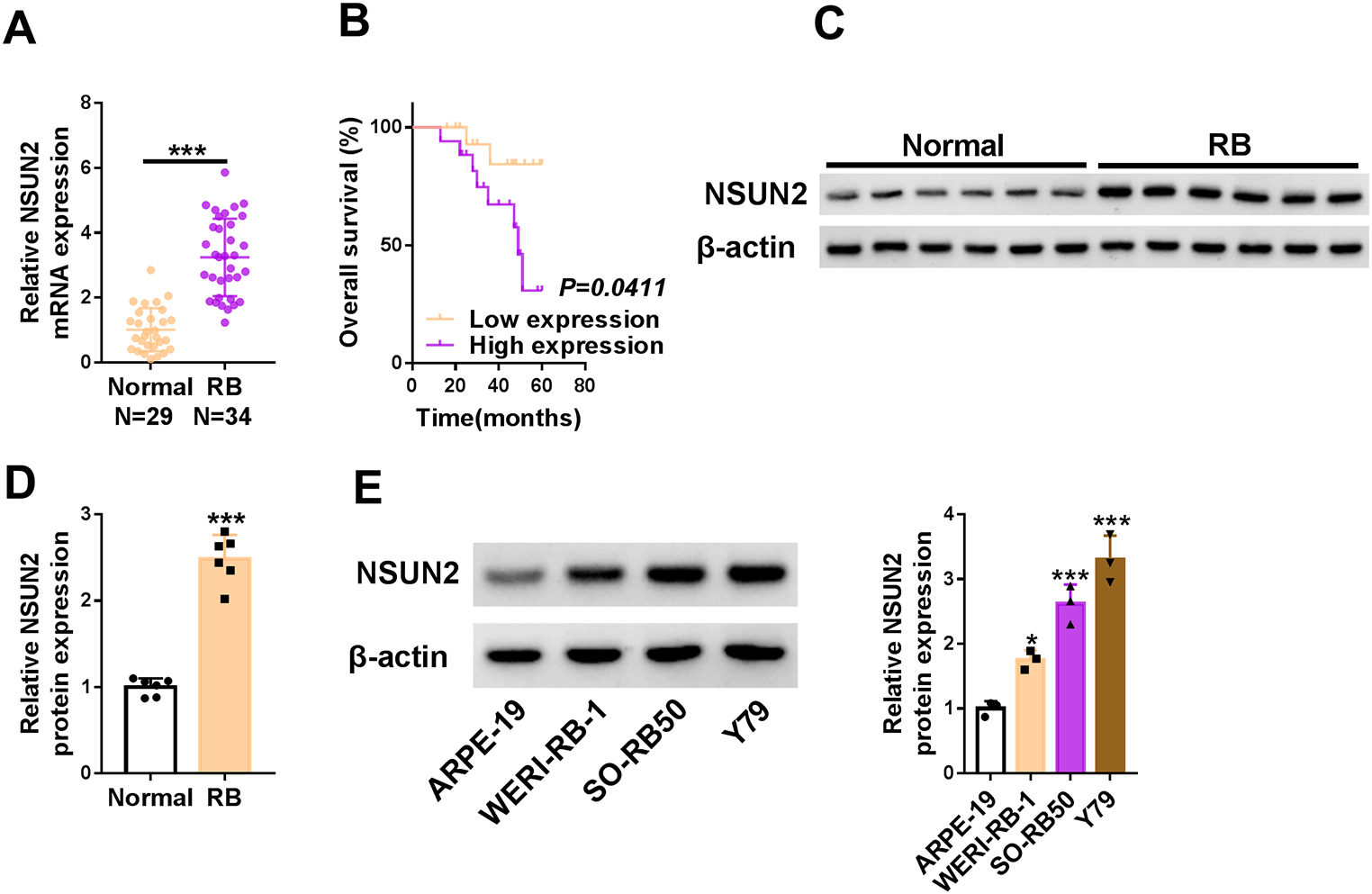NSUN2 contributes to the RB malignant progression and Glycolysis by mediating the m5C methylation modification of HKDC1