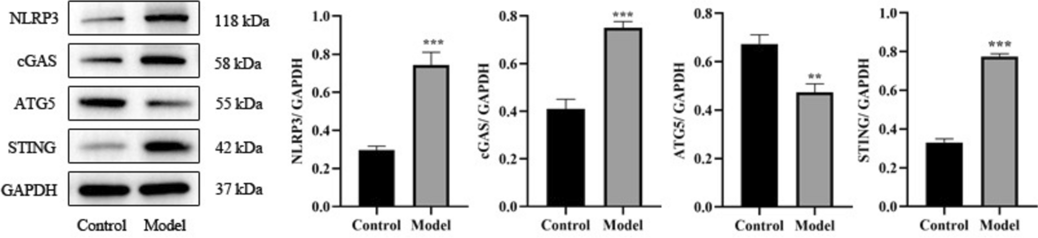 ATG5-mediated cGAS-STING-NLRP3 axis alleviates symptoms of knee osteoarthritis