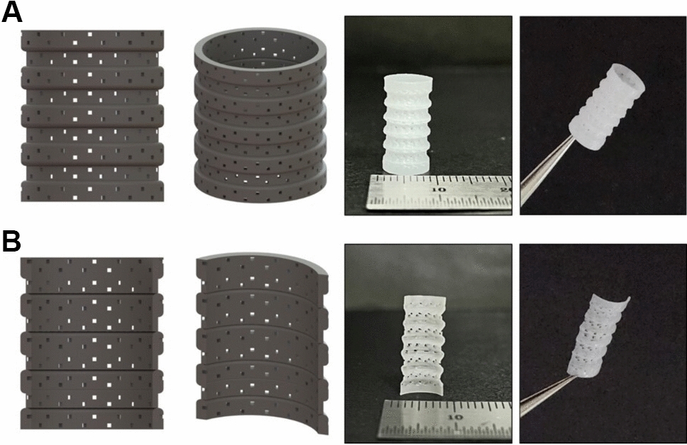 Characteristics of 3D-Printed Polycaprolactone Tracheal Scaffolds Implanted