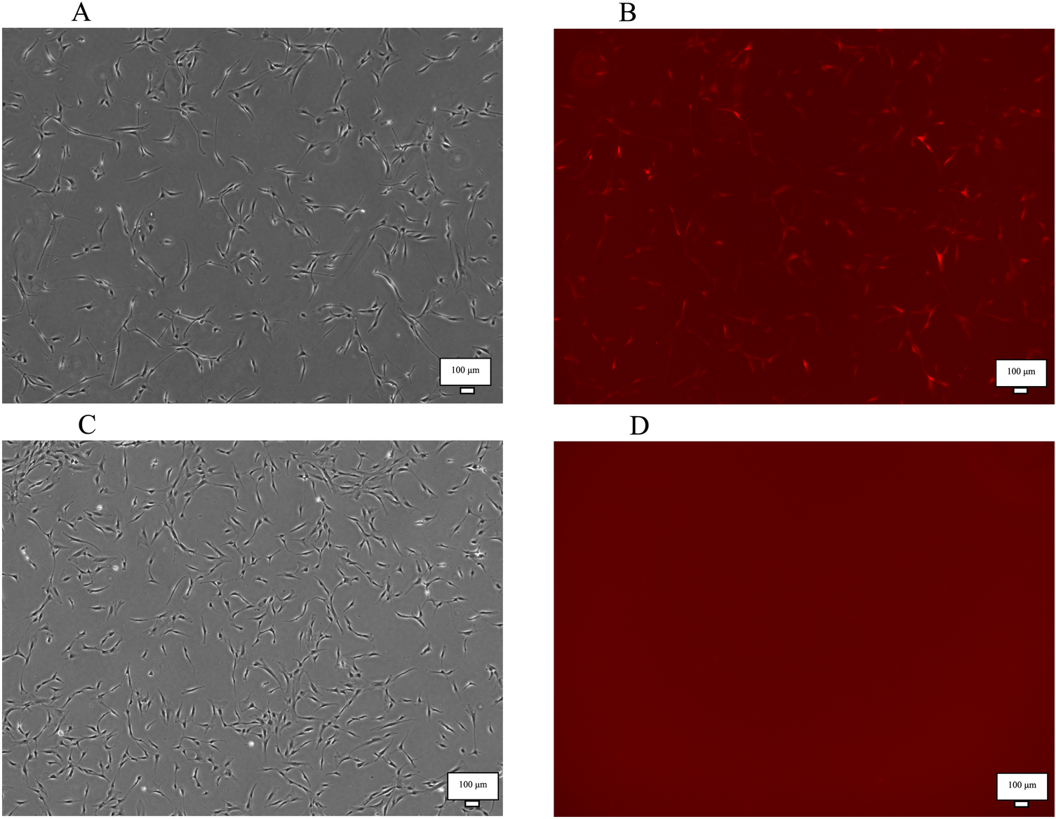 Angiogenic Ability of Extracellular Vesicles Derived from Angio-miRNA-Modified Mesenchymal Stromal Cells