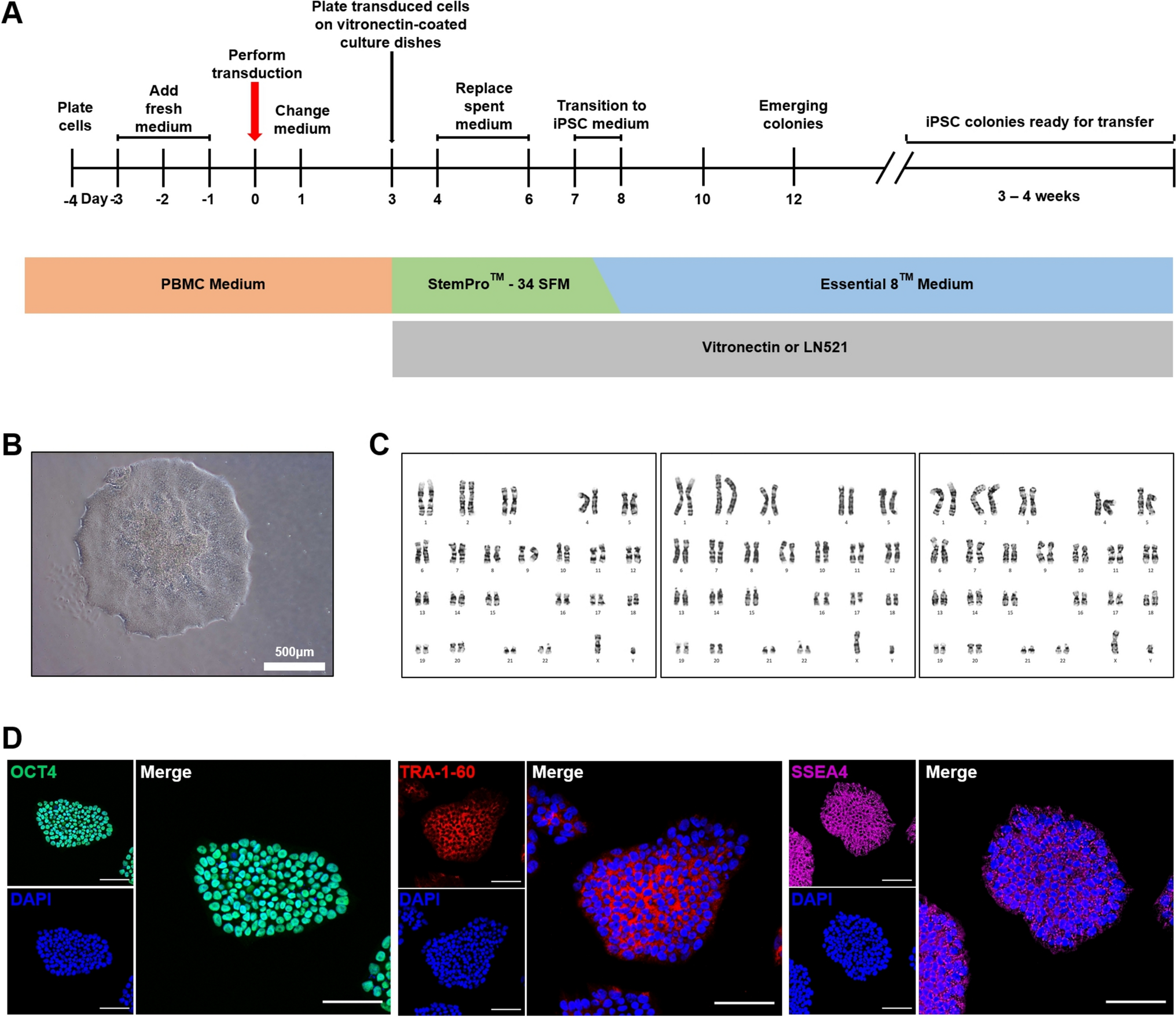 Establishment of Immune-Evasive iPSCs from PBMCs Using B2M Knockout and CD47/HLA-E Overexpression