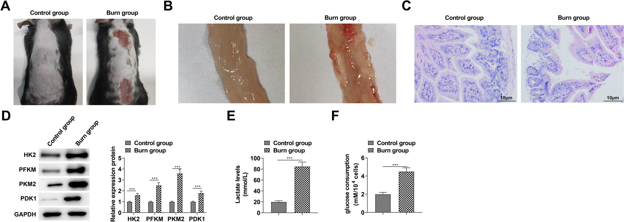 circRNA_Atp8a1 Promotes Glycolytic Reprogramming in Damage of Intestinal Mucosal Barrier by Upregulating IGF2 through miR-200b-3p