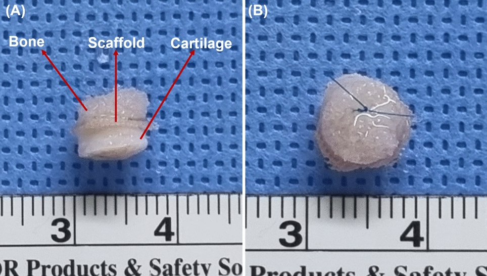 Phenotype-Preserving Co-culture of Osteoblasts and Chondrocytes Enhances Bone-Cartilage Interface Integration in a PRP-Augmented Scaffold