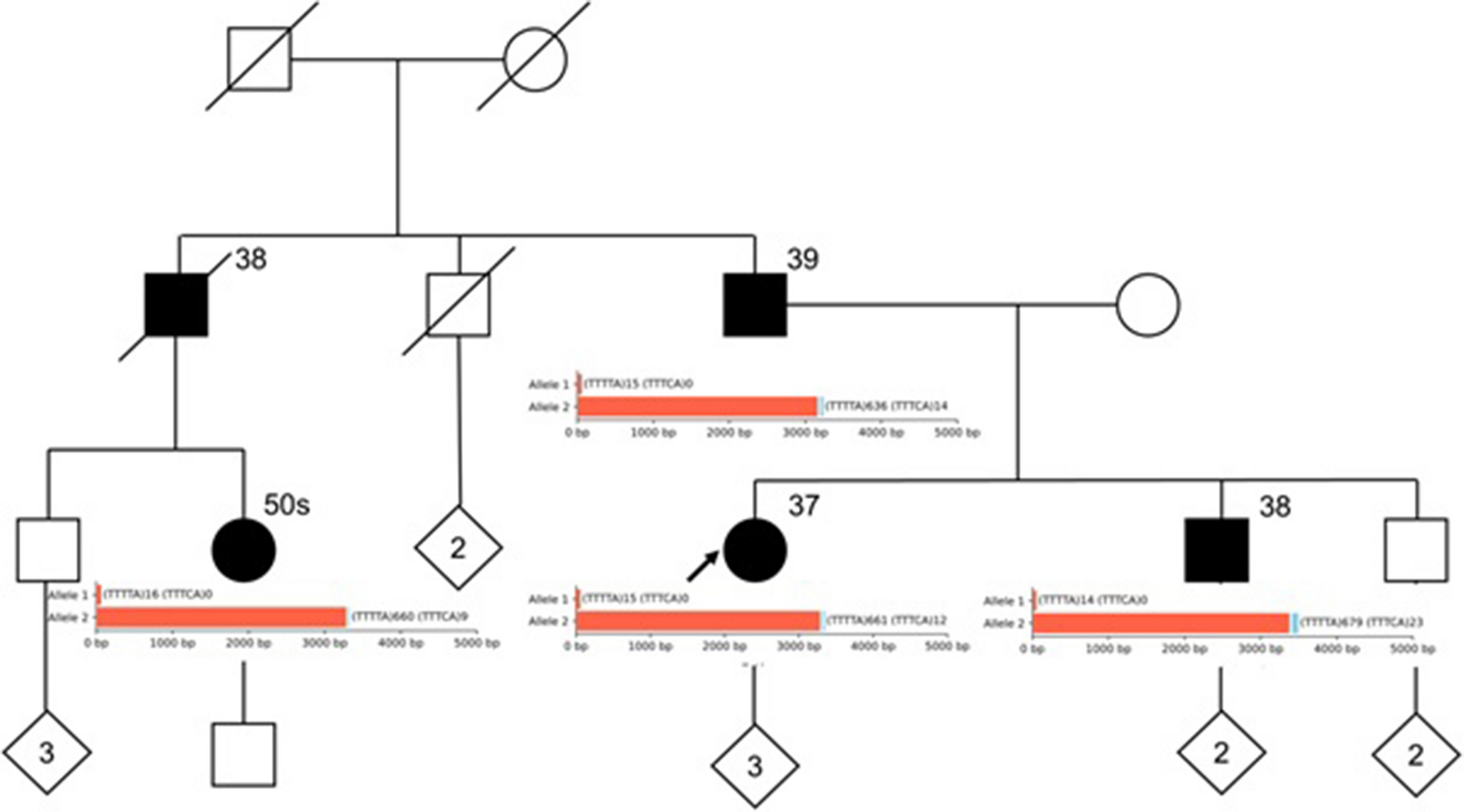First clinical diagnosis of FAME3 via commercial Long-Read sequencing reveals mosaic repeat expansion in