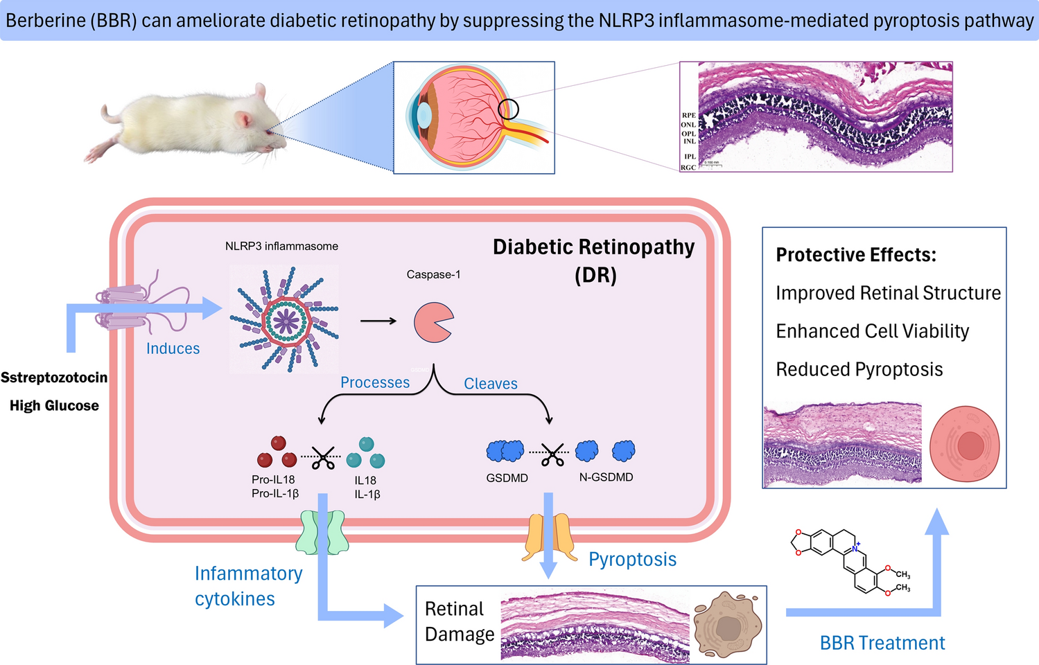 Berberine attenuates the expression of NLRP3 and downstream inflammasome effectors in diabetic retinopathy