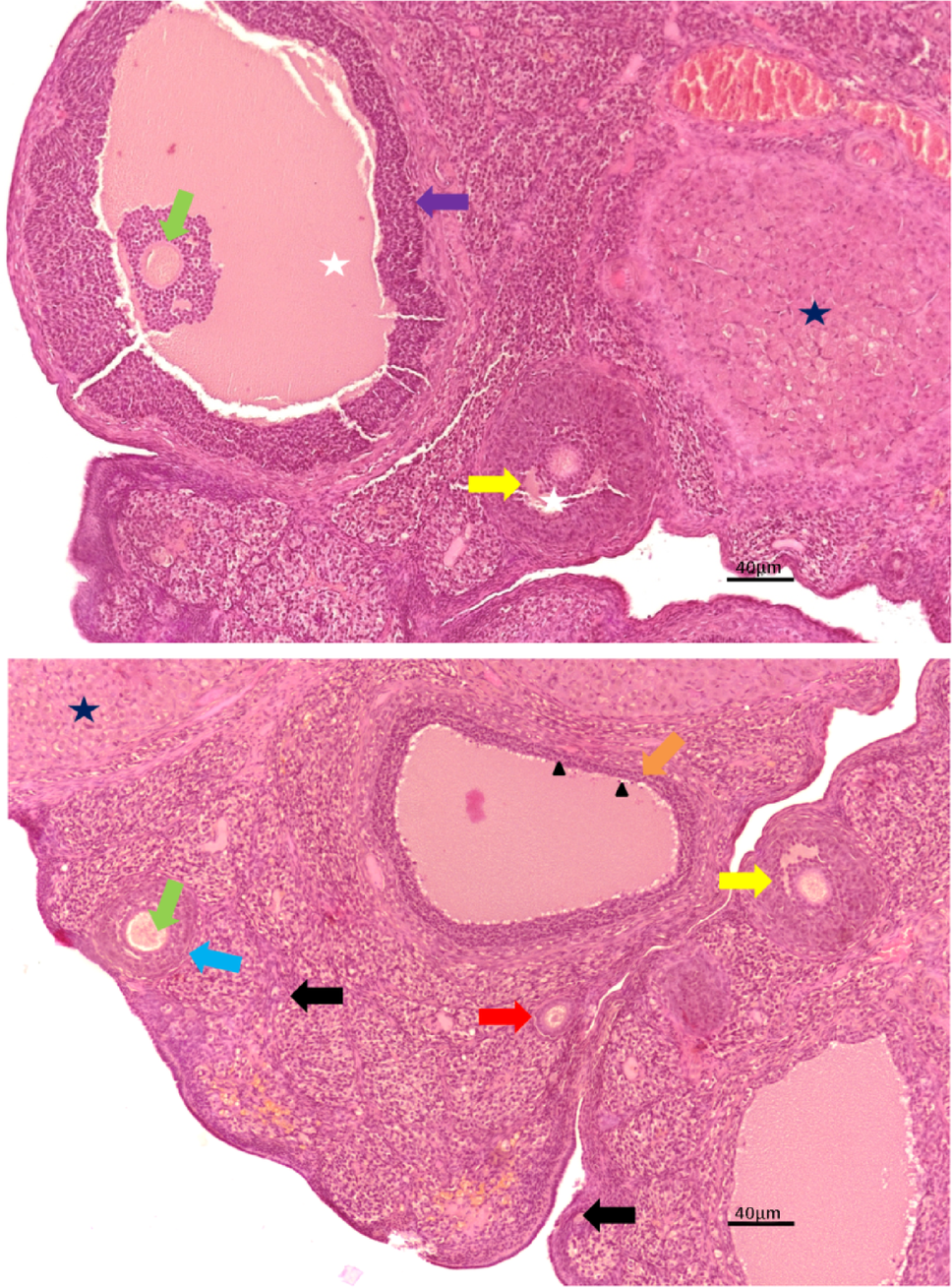 Coenzyme Q10 may protect ovarian tissue against by the nearly century-old drug methotrexate caused gonadotoxicity: a biochemical, flow cytometric, and histopathological study