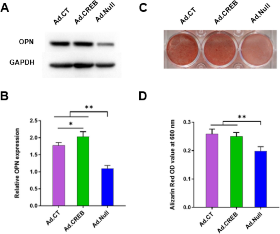 Calcitonin promotes osteogenic differentiation through CREB-mediated transcriptional upregulation of osteopontin in human periodontal ligament stem cells