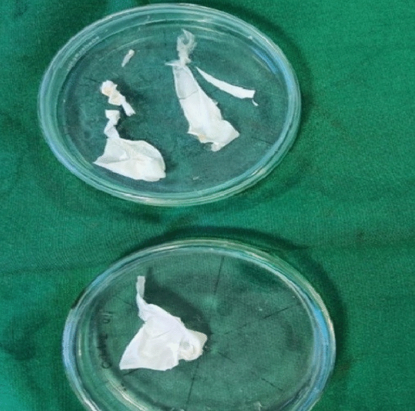 Evaluation of angiogenic, osteogenic, and antimicrobial potential of novel type X collagen-derived GBR membrane: an in vivo preliminary study