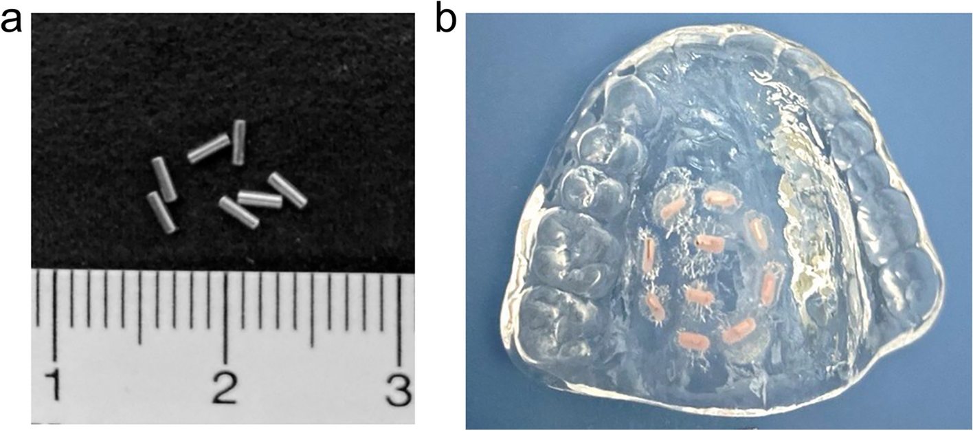 Efficacy of low-dose rate brachytherapy utilizing a mold with gold-198 grains for hard palate and gingival cancer