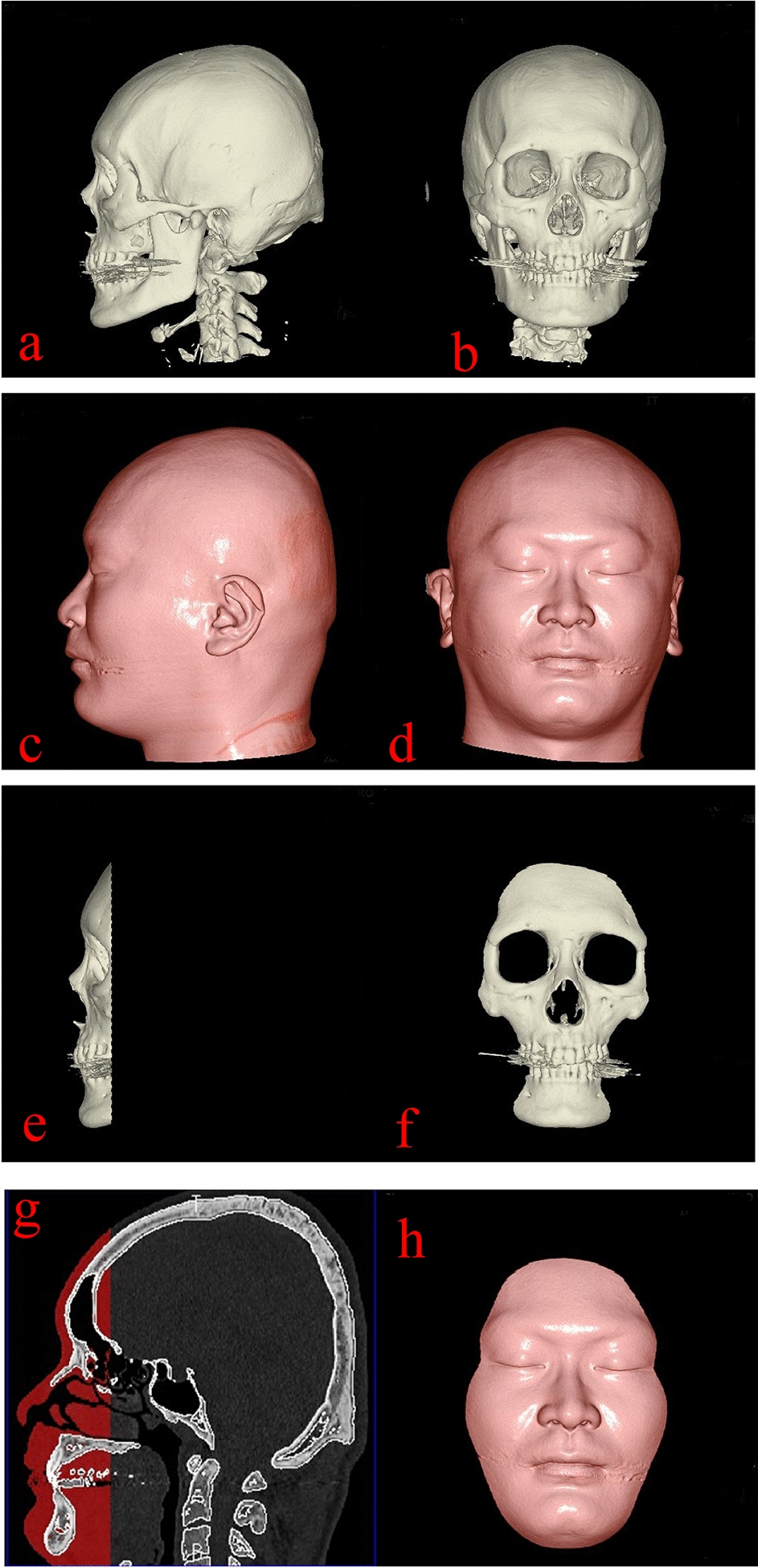 Fundamental research into the creation of reconstructed facial images with low creator dependence