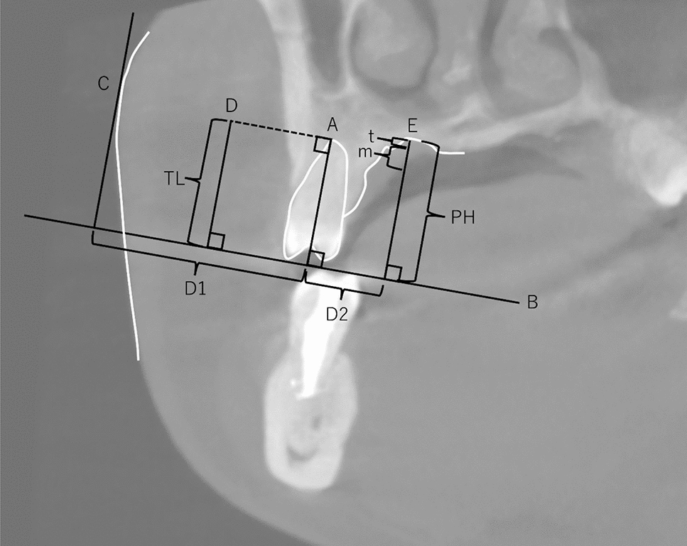 Is it possible to apply a paralleling technique to different ethnicities in Hong Kong?