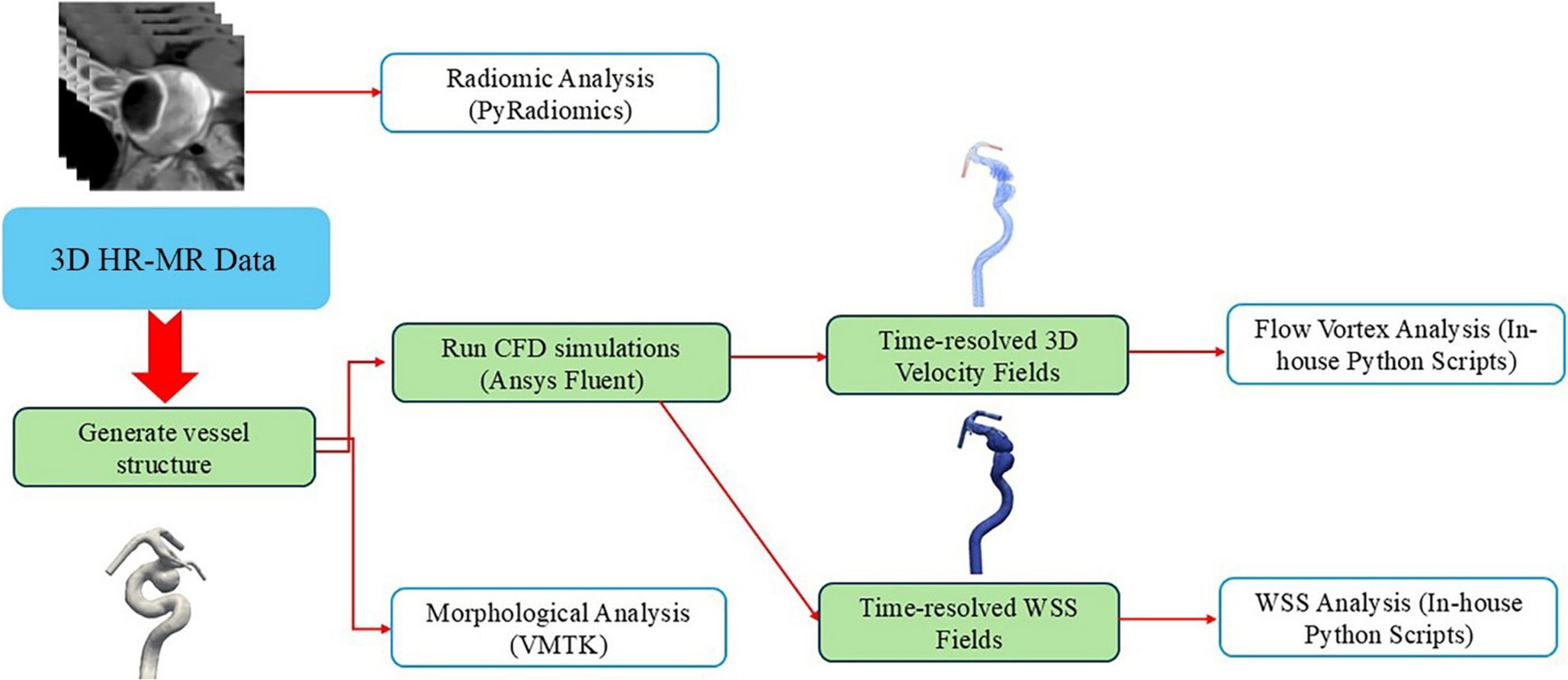 Correlations between hemodynamics and radiomic features in thrombosed intracranial aneurysms