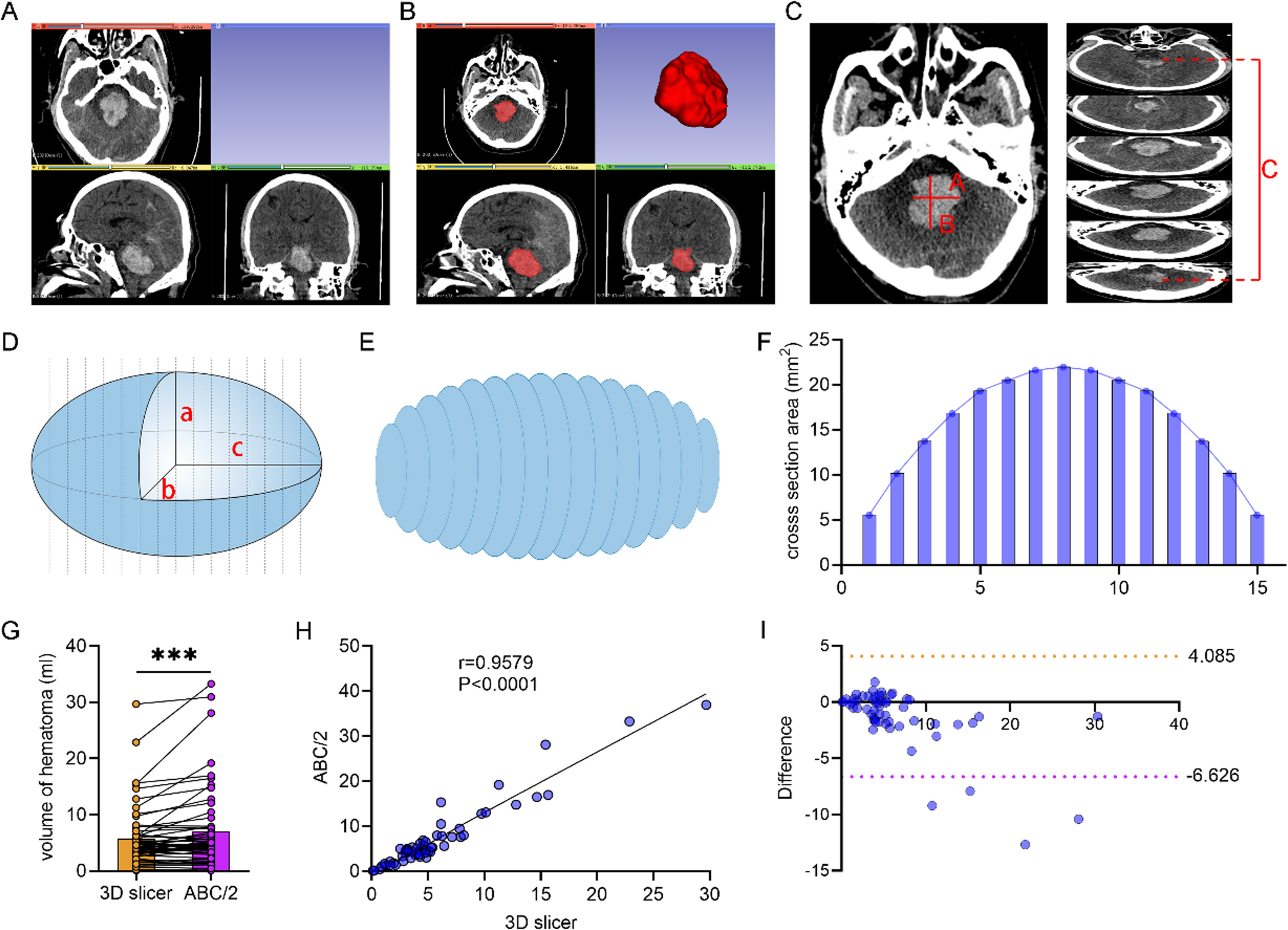 Comparison of brainstem hematoma volume evaluation techniques with a novel quantitative approach