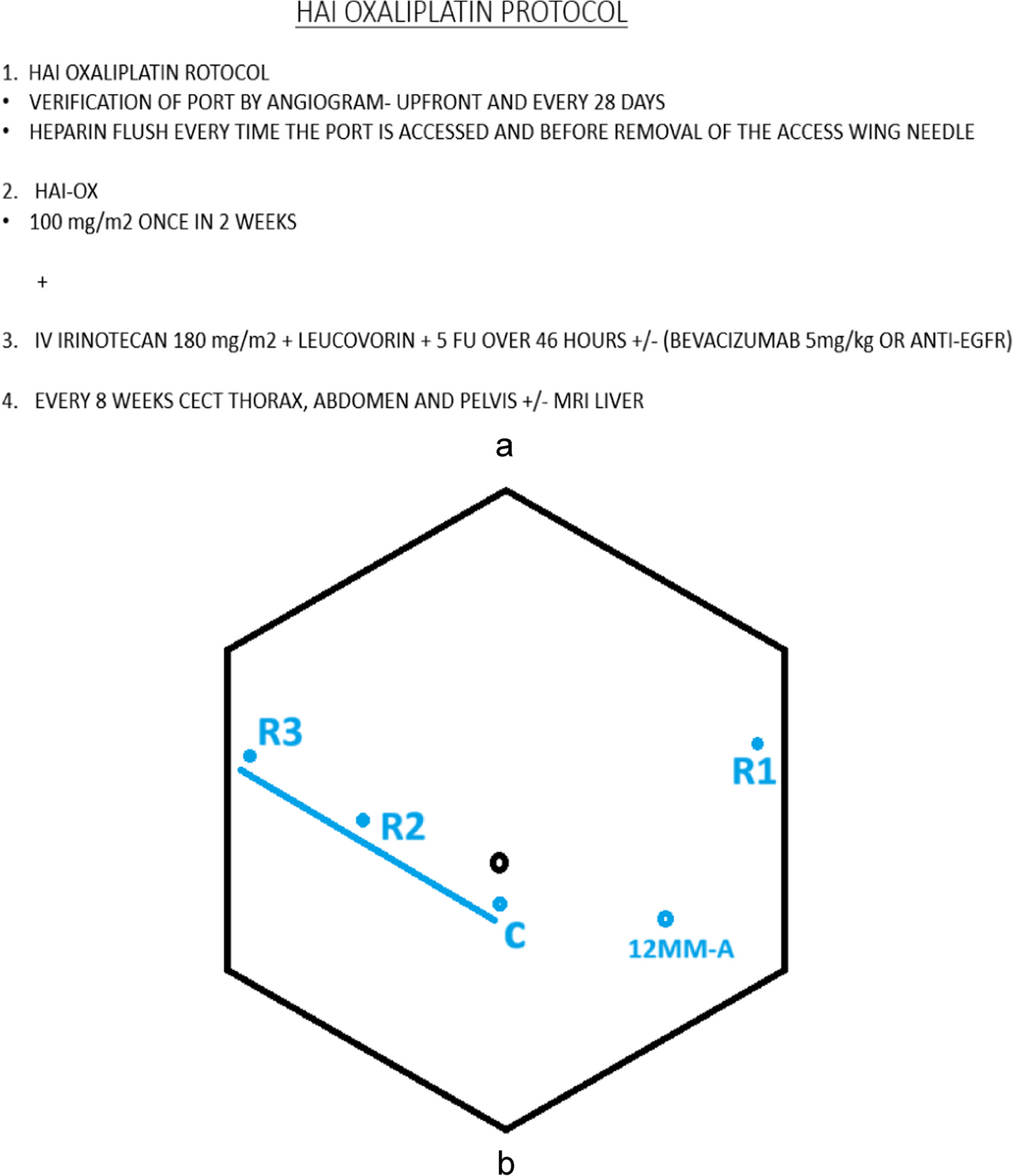 Robotic Hepatic Artery Infusion (HAI) Port Placement for Liver-Directed Intra-Arterial Chemotherapy: Initial Experience from a Tertiary Care Indian Cancer Center