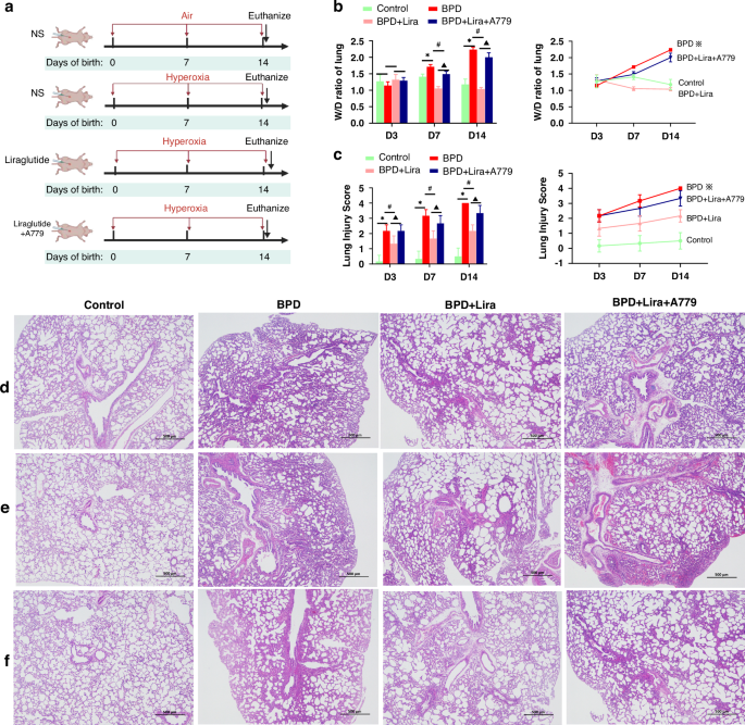 Bronchopulmonary dysplasia induced by hyperoxia attenuated by A GLP-1 analog, Liraglutide, by regulating the ACE-2/Ang(1-7)/Mas receptor pathway