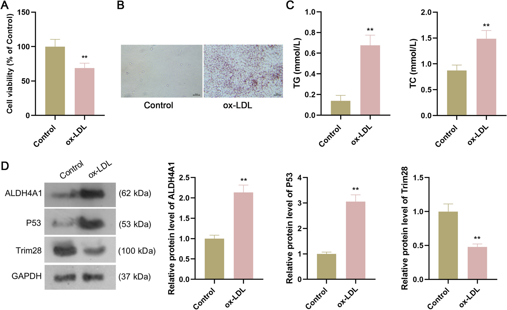 ALDH4A1 knockdown inhibits in vitro atherosclerosis model by modulating Trim28-mediated P53 ubiquitination to suppress ferroptosis of vascular endothelial cells