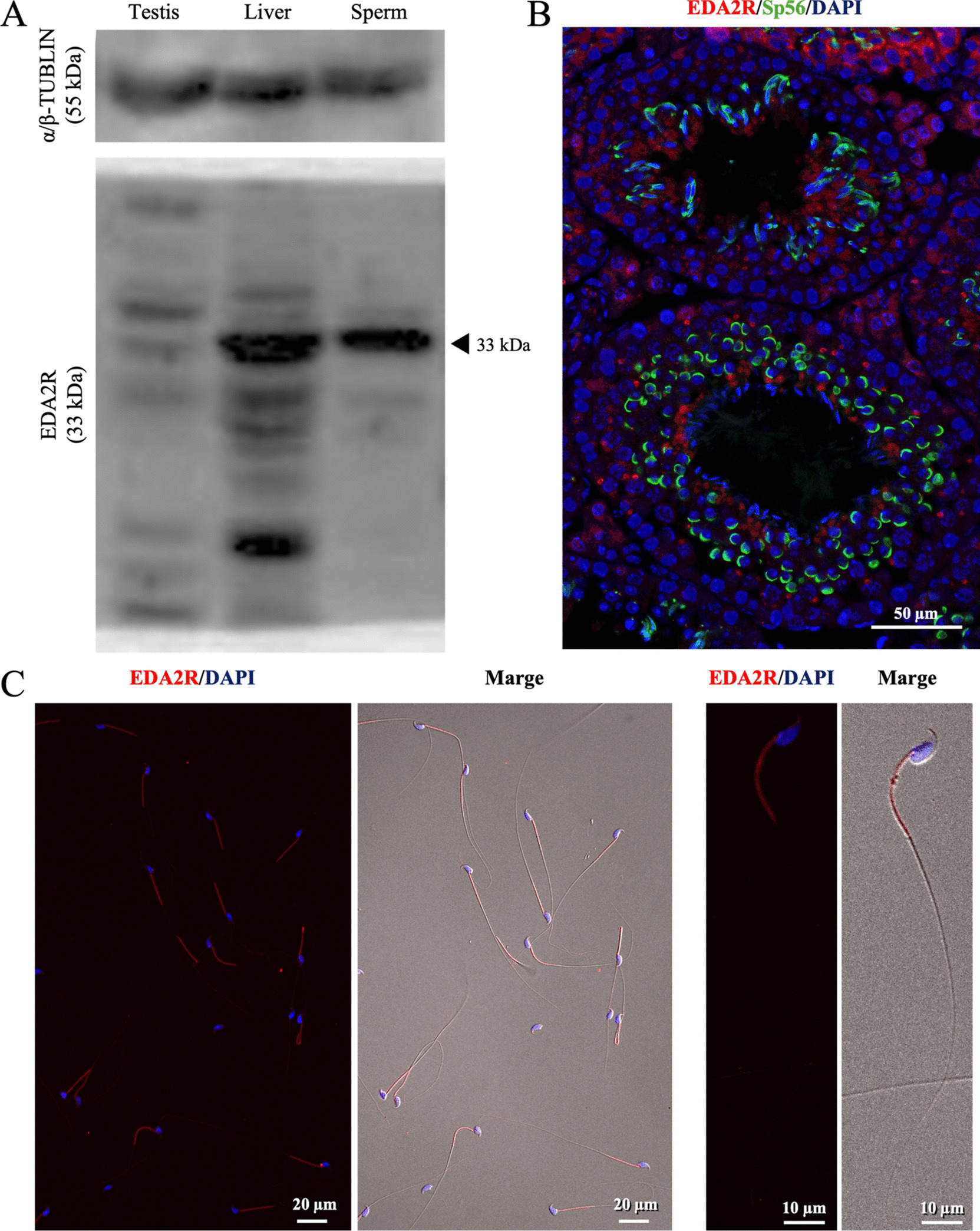 Functions of ectodysplasin A2 receptor (EDA2R) in inducing capacitation of sperm in mice