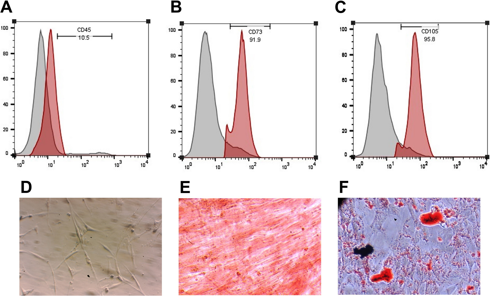 Bone marrow–derived mesenchymal stem cells and their extracellular vesicles suppress splenocyte activation and ameliorate experimental autoimmune encephalomyelitis