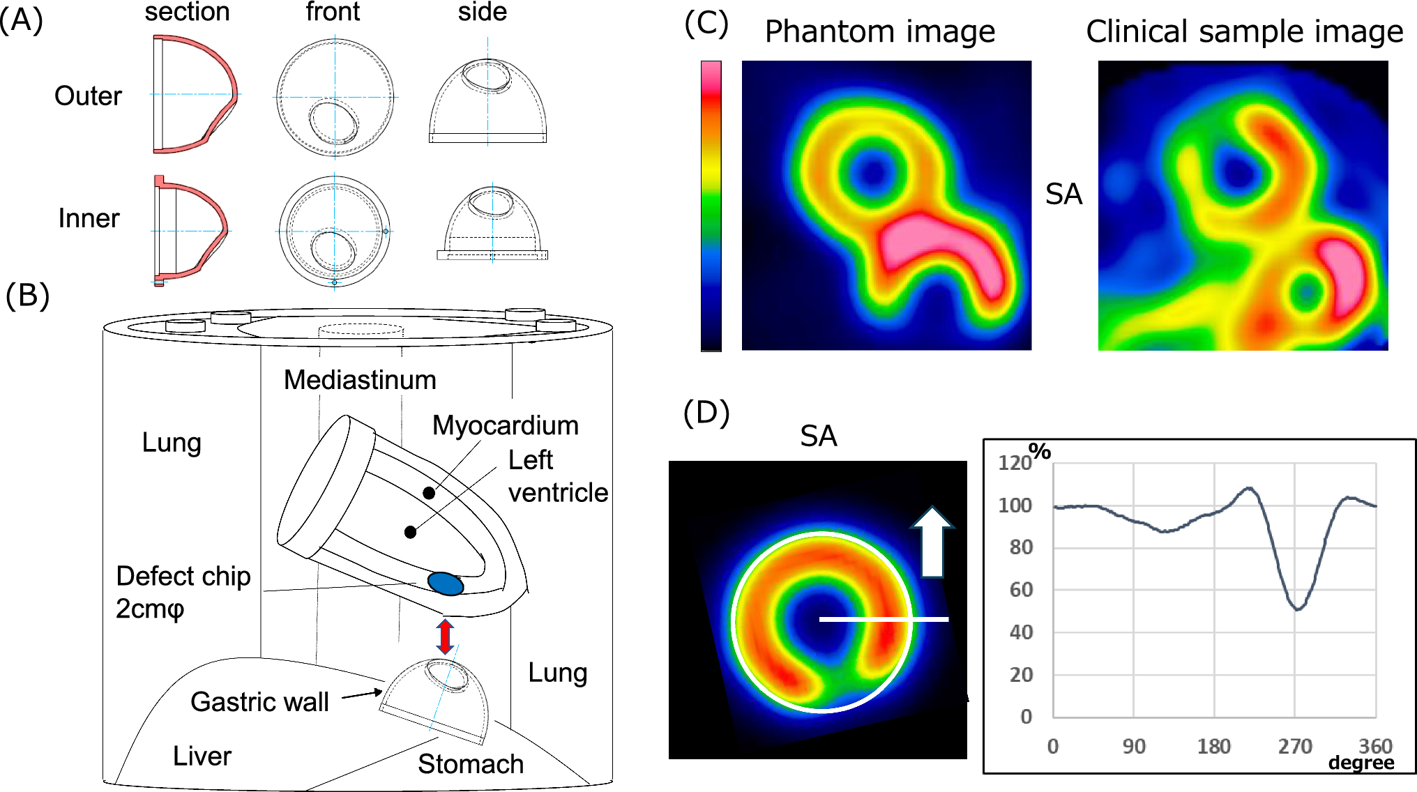 Evaluation of the usefulness of the masking on un-smoothed image method in Tl myocardial perfusion SPECT