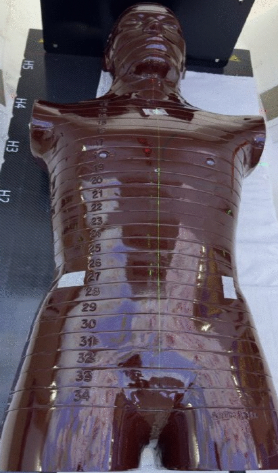 Comparative dosimetric analysis of base dose and gradient-based optimization in overlapping regions of extended target volumes using an anthropomorphic phantom