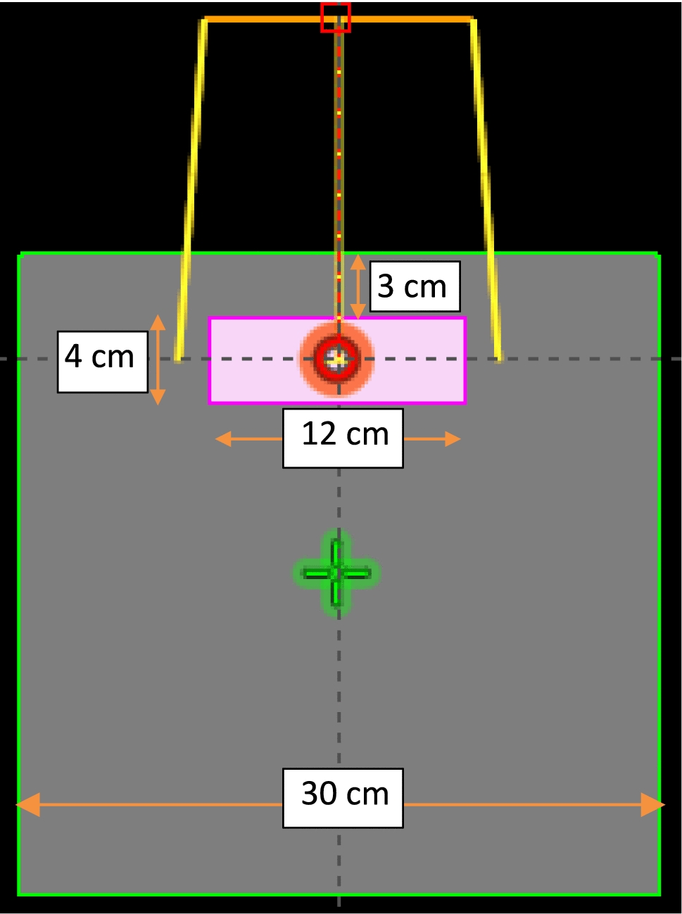 Dosimetric impact of material misassignment in linear Boltzmann transport equation-based external beam radiotherapy dose calculation